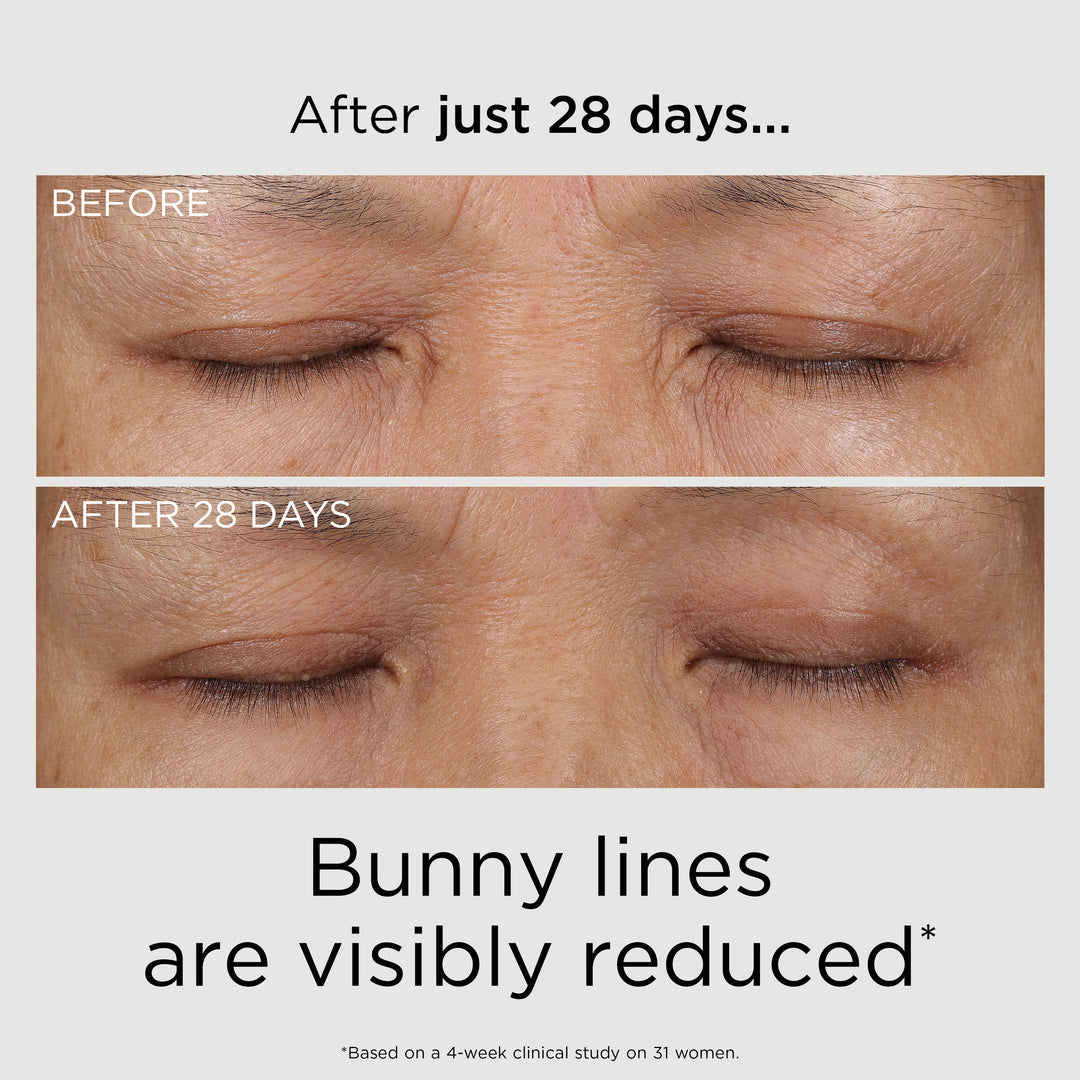 PREVAGE® 3-in-1 Reset Serum