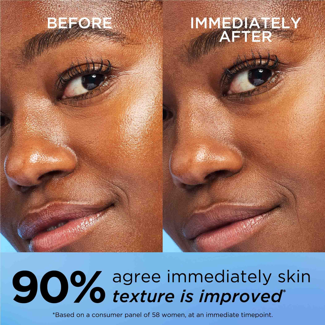 Before and After. 90% agree immediately skin texture is improved* *Based on a consumer panel of 58 women, at an immediate timepoint.