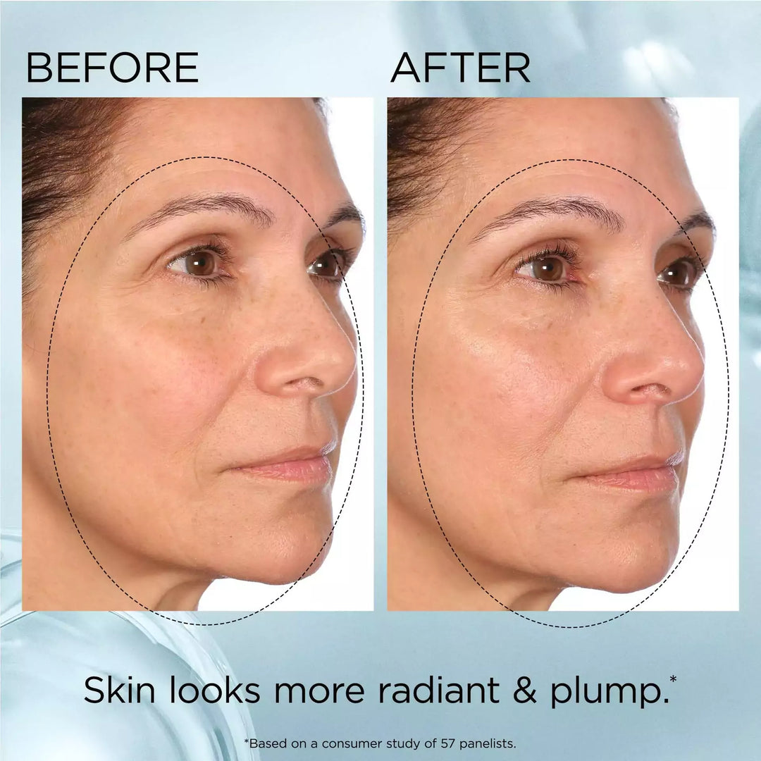 Before and After- Skin looks more radiant and plump* *based on a consumer study of 57 panelists.