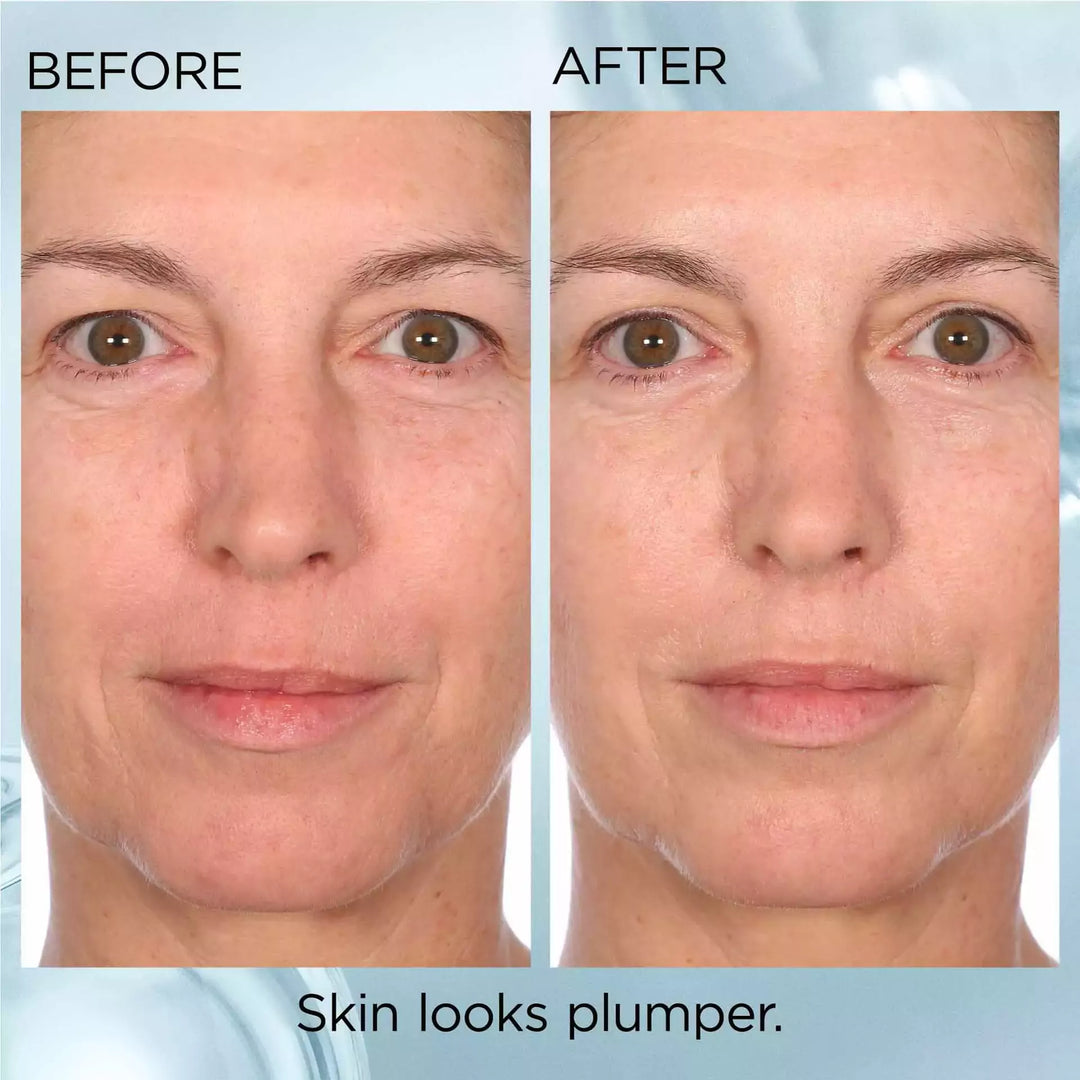 Before and After- skin looks plumper