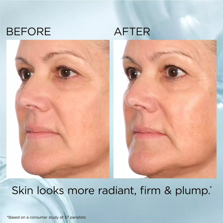 Before and After- The skin looks more radiant, firm and plump* *Based on a consumer study of 57 panelists.