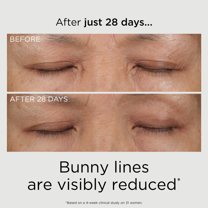 PREVAGE® 3-in-1 Reset Serum