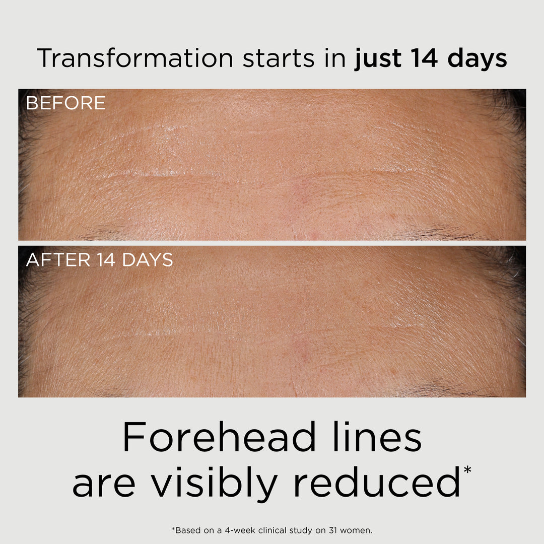 PREVAGE® 3-in-1 Reset Serum