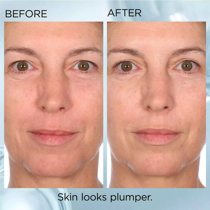Before and After- skin looks plumper